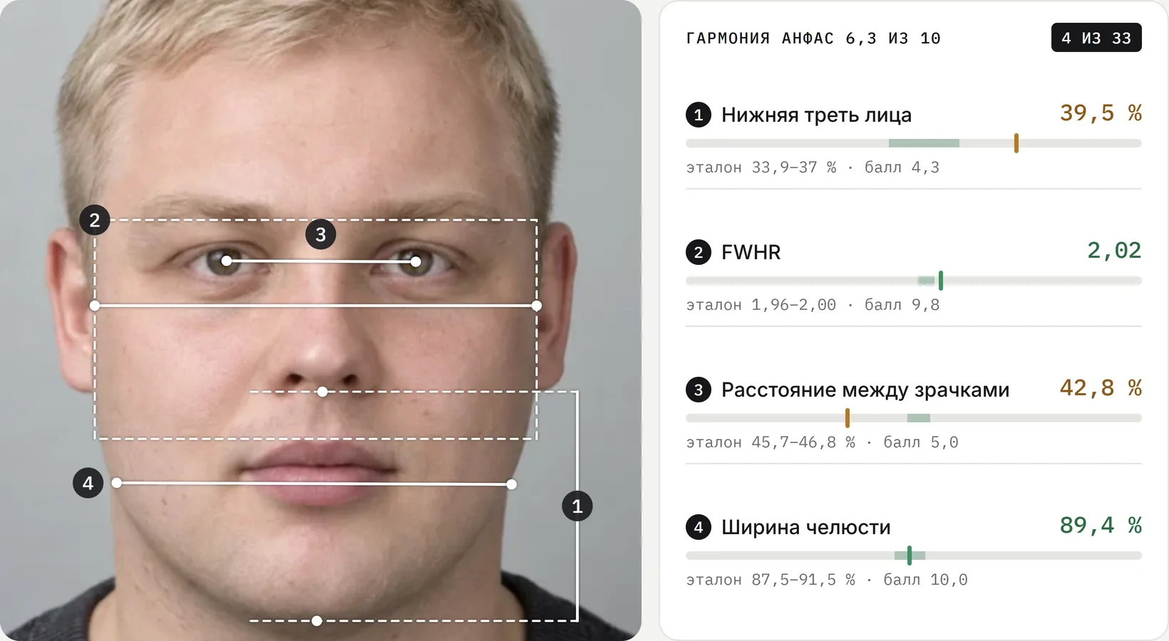 Кадр отчёта: нижняя треть, FWHR, расстояние между зрачками и ширина челюсти линиями на фото и те же пропорции с эталонами